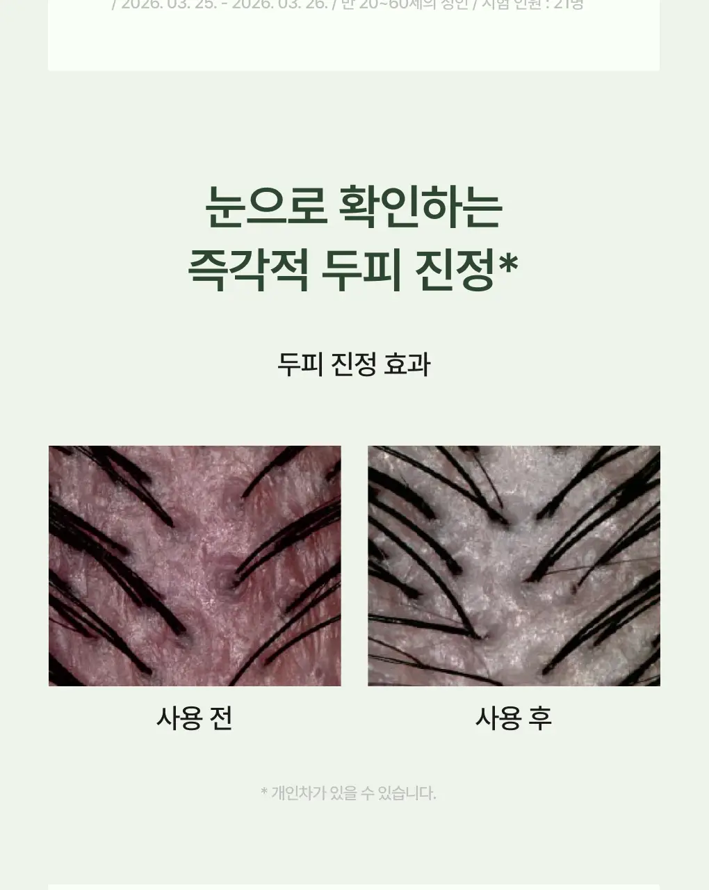 [1위 다시마샴푸] 청미정 다시마 샴푸&트리트먼트 듀오 기획 상세페이지 34